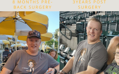How Back Surgery Taught Me the Truth About Fitness and Long-Term Health